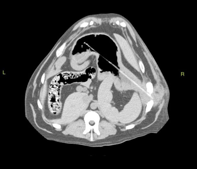 dog with skewer on CT